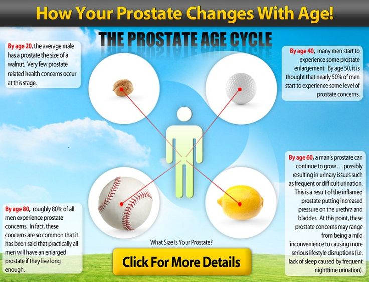 41 best images about Enlarged Prostate on Pinterest ...