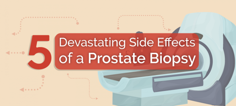 5 Devastating Side Effects of a Prostate Biopsy