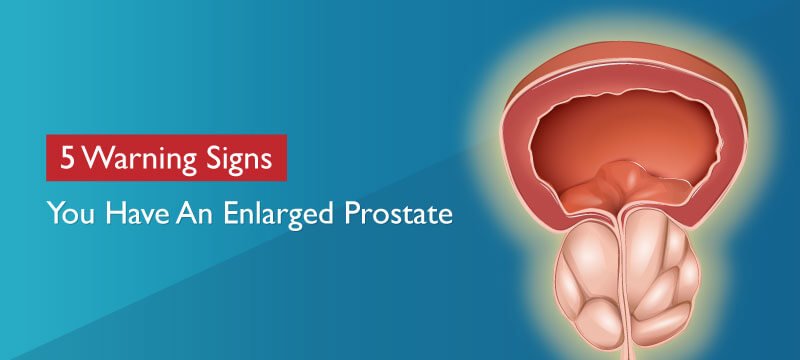 5 Warning Signs You Have An Enlarged Prostate
