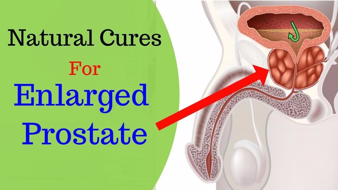 6 effective home remedies to treat prostate enlargement ...