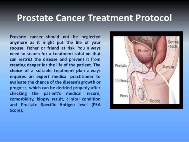 Alternative prostate cancer treatments