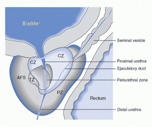 Anatomy and Pathology of Prostate Cancer