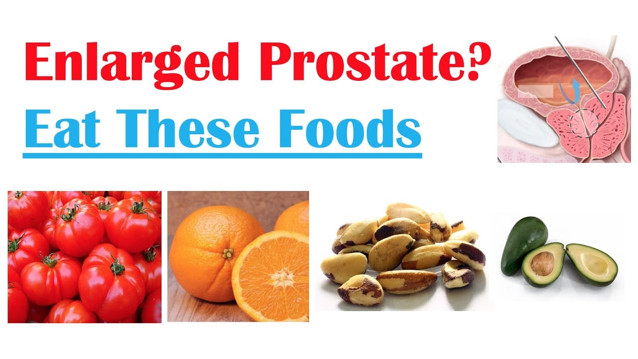 Best Foods to Eat with Enlarged Prostate