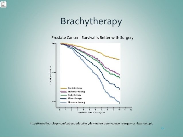 Brachytherapy: Prostate Cancer
