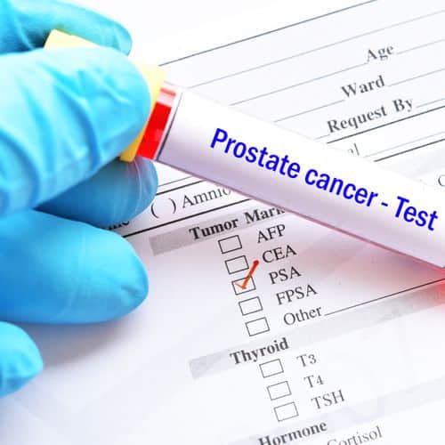 Cancer de la prostate : symptÃ´mes, diagnostic, le dÃ©pister et le ...