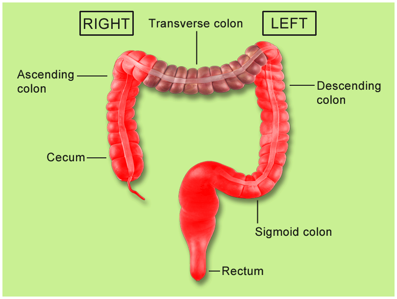 Cancer of the colon versus. rectal cancer: whats the ...