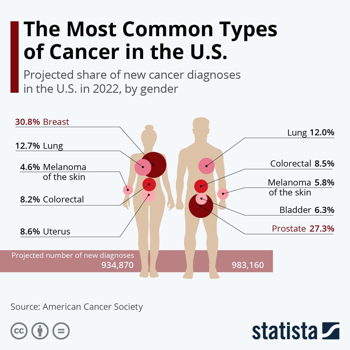 Chart: The Most Common Types of Cancer in the U.S.