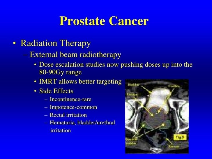Current Diagnosis And Management Of Prostate Cancer
