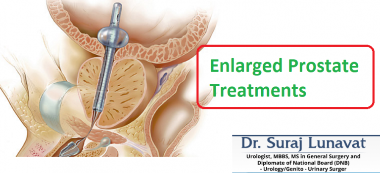 Evaluating the Signs of an Enlarged Prostate