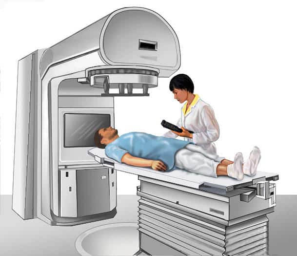 External Beam Radiation Therapy for Cancer