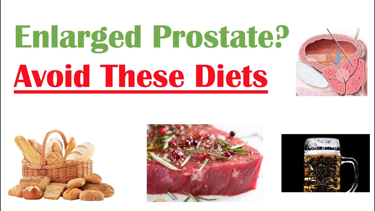 Foods to Avoid with Enlarged Prostate