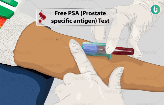 Free PSA (Prostate specific antigen) Test: Procedure ...