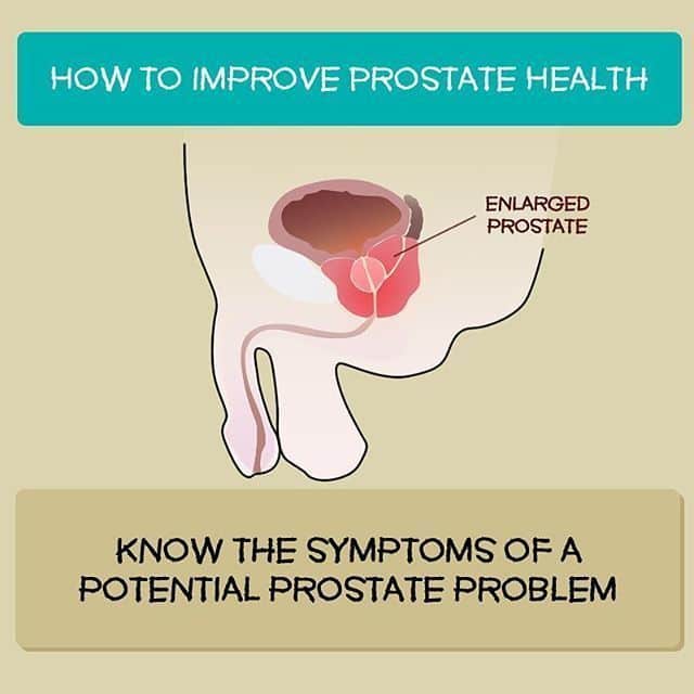How To Find The Prostate Gland Video