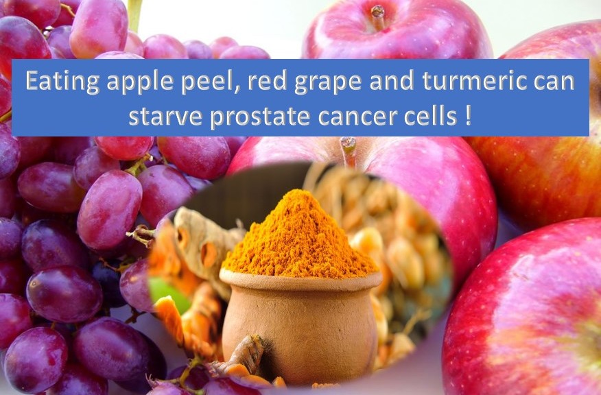 How to starve and kill prostate cancer cells ...