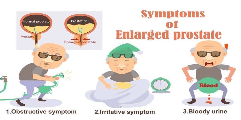 How to treat prostate enlargement naturally?