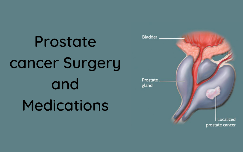 Ikris Pharma Blog: List of Surgery for Prostate Cancer