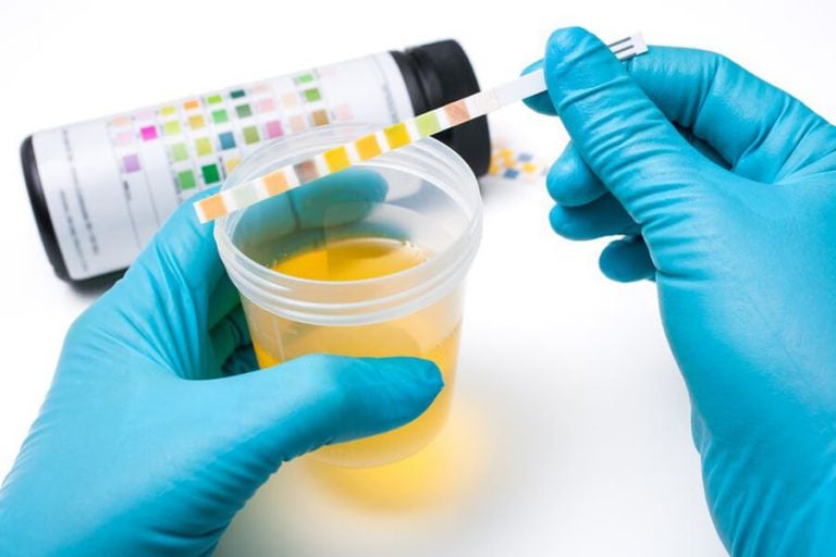 New Urine Test Can Diagnose Prostate Cancer Earlier ...