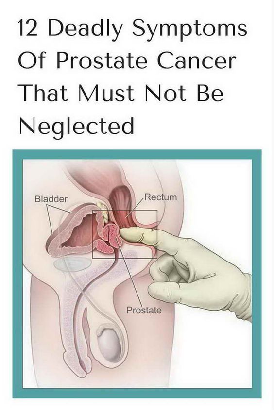 Post Prostate Surgery
