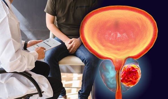 Prostate cancer: If a man experiences this sexual symptom it could mean ...
