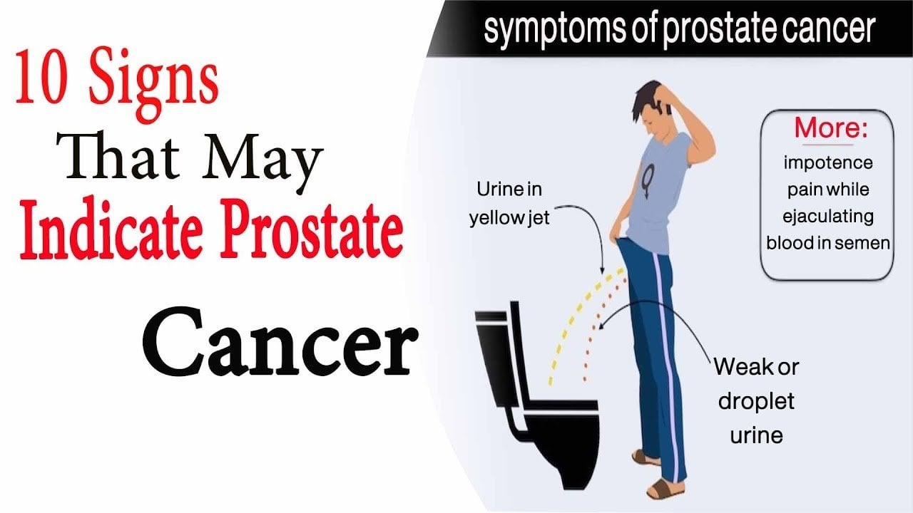 Prostate cancer signs