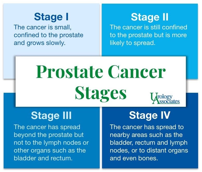 Prostate Cancer Stages &  Options