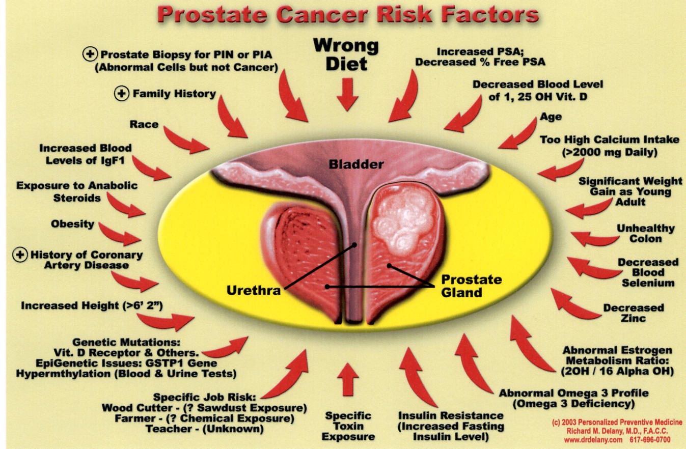 Prostate Cancer Survival Rates