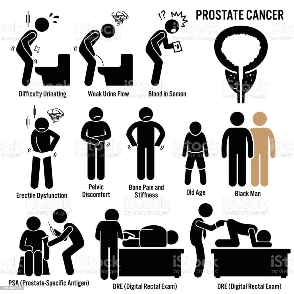 Prostate Cancer Symptoms Causes Risk Factors Diagnosis Stick Figure ...