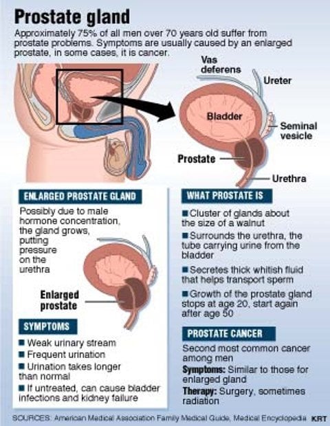 Prostate Health Reduce Blockage and Cancer Prevention ...