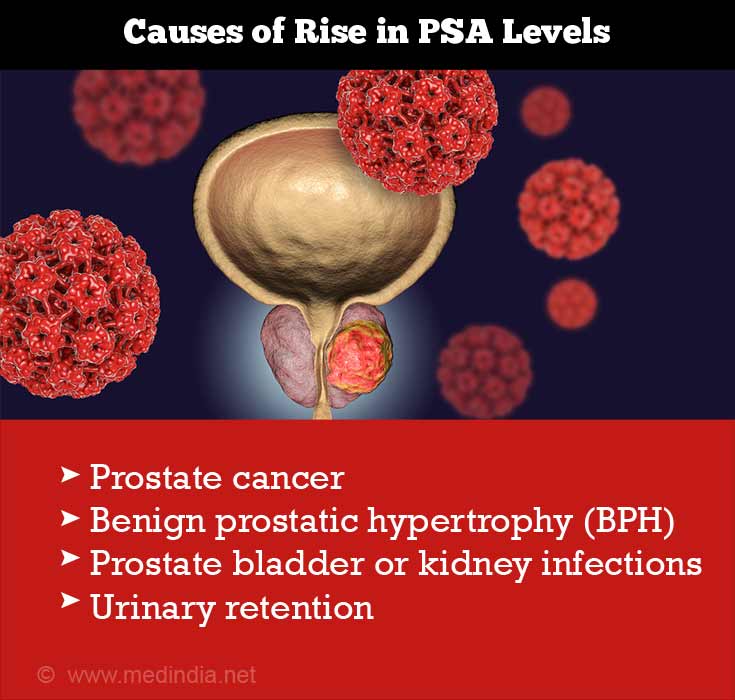 Prostate Specific Antigen [PSA] &  Prostate Cancer Diagnosis