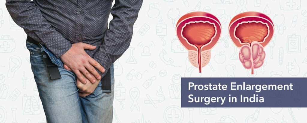 Prostate Surgery Cost in India, Prostate Enlargement ...