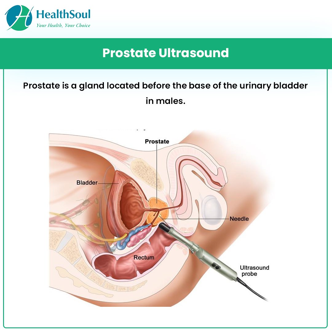 Prostatectomy: Indications and Risks  Healthsoul