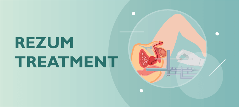 Rezum Treatment  A New Treatment For An Enlarged Prostate?