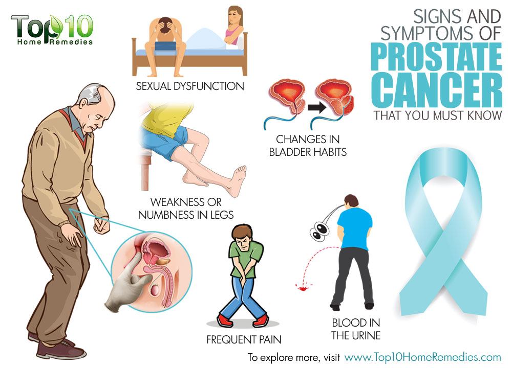 Signs and Symptoms of Prostate Cancer that You Must Know