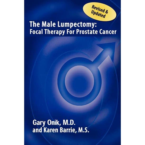 The Male Lumpectomy : Focal Therapy for Prostate Cancer