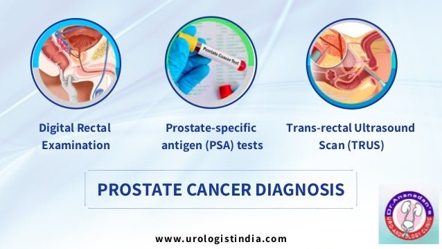 Treatment for Prostate Cancer Chennai