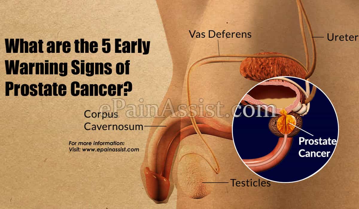 What are the 5 Early Warning Signs of Prostate Cancer?