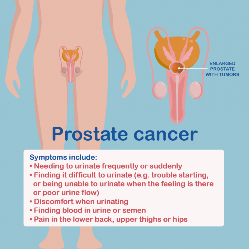 What Are The Signs Of Prostate Cancer In A Man