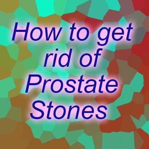 What are treatments for prostate stones?
