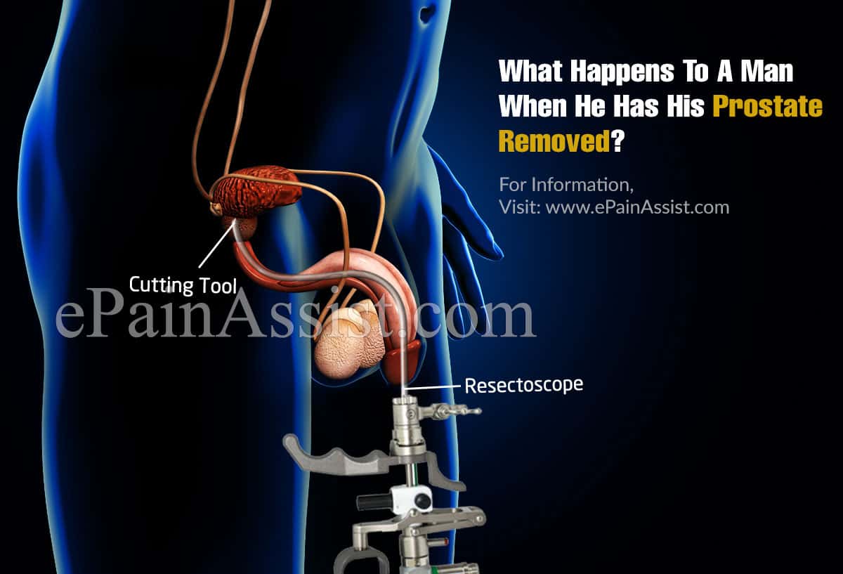 What Happens To A Man When He Has His Prostate Removed?