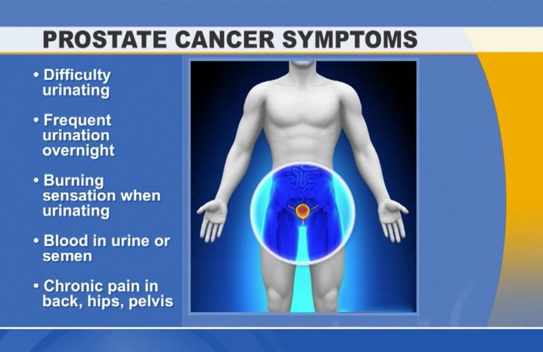 What Is Prostate Cancer  9 Signs And Symptoms