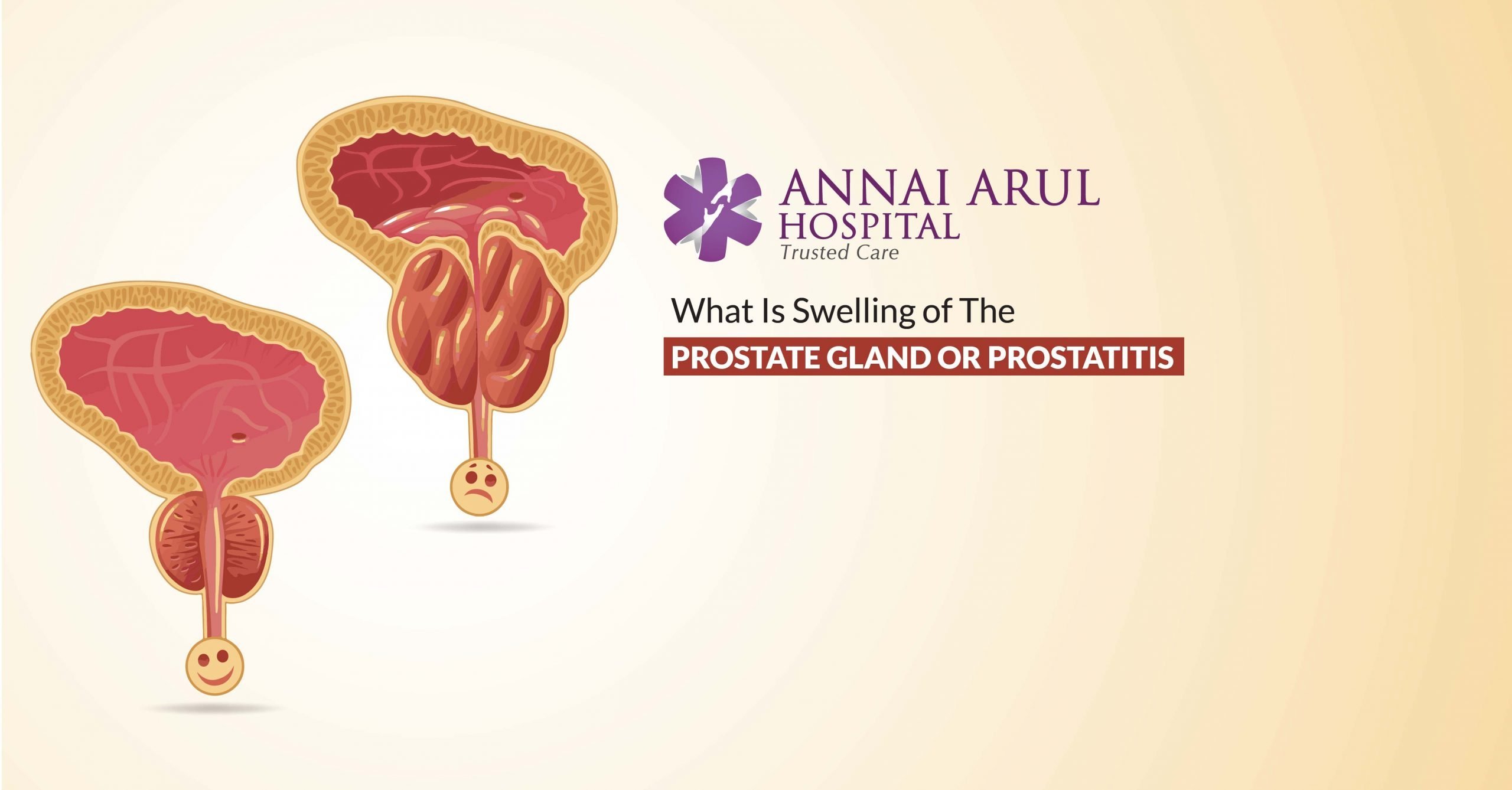 WHAT IS SWELLING OF THE PROSTATE GLAND OR PROSTATITIS ...