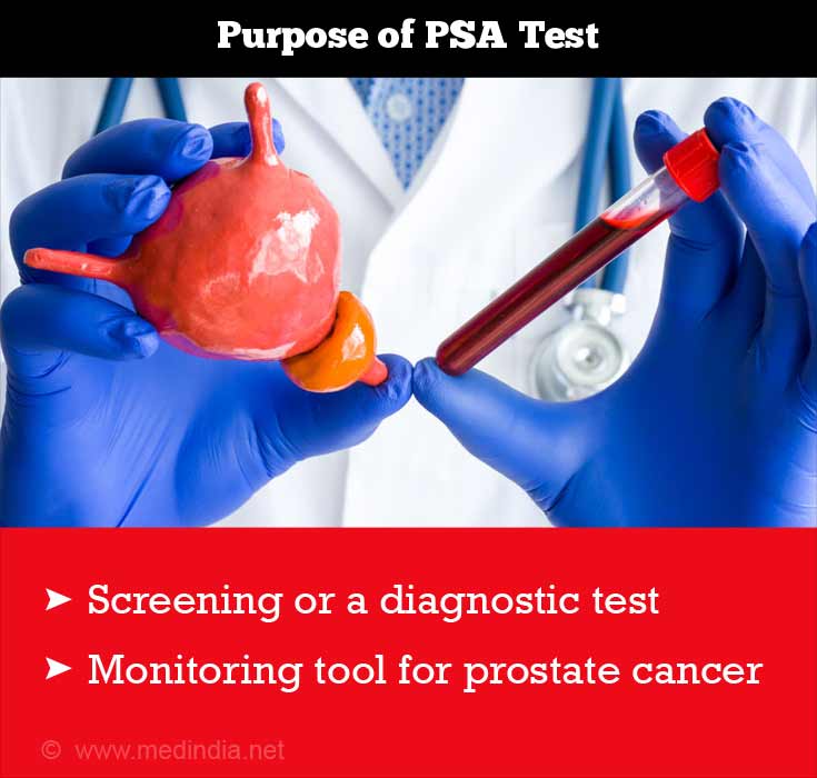 When is PSA test done &  Screening for Prostate Cancer