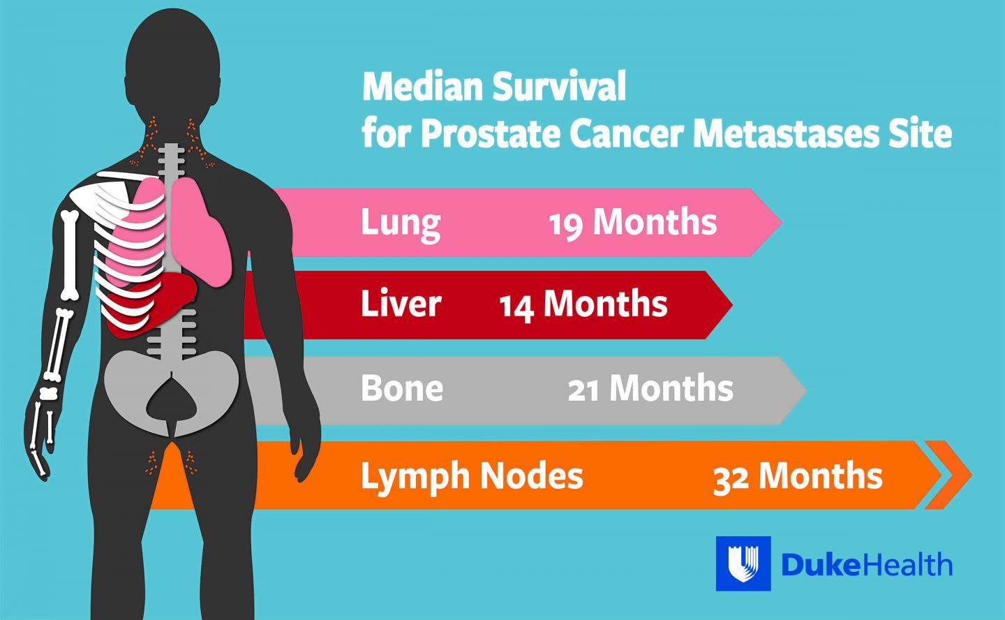Where prostate cancer spreads in the body affects survival ...